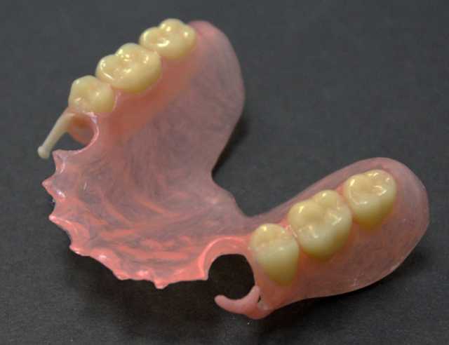 Предложение: Установка протезов зубов, протезирование