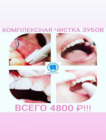 Предложение: Комплексная чистка зубов  всего 4800!