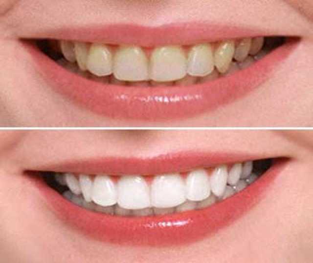 Предложение: Лечение зубов в центре эстетической стом