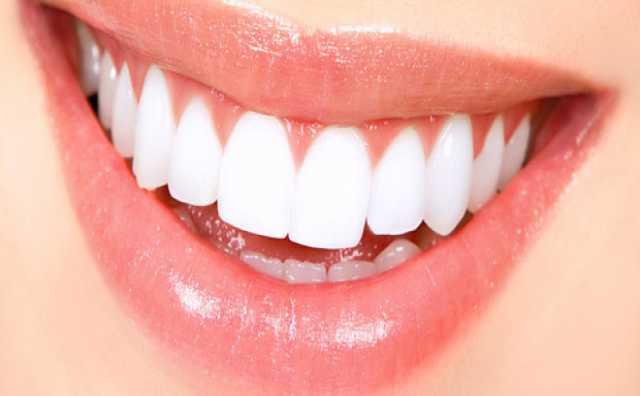 Предложение: Эстетическая реставрация зубов