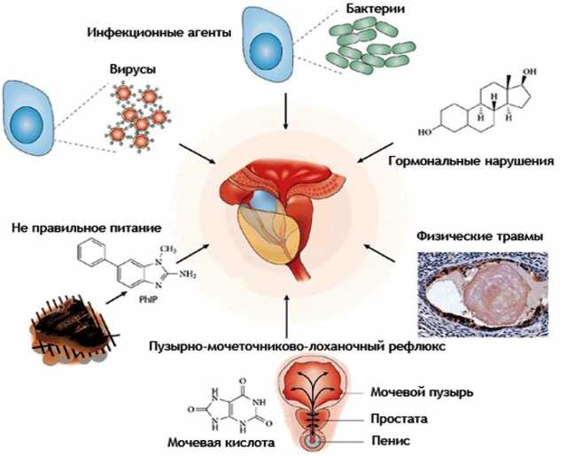 Предложение: Массаж простаты