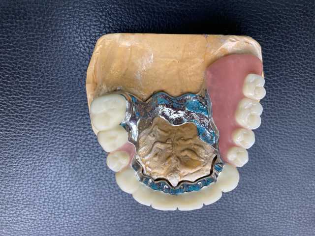 Предложение: Зубной техник съемное протезирование