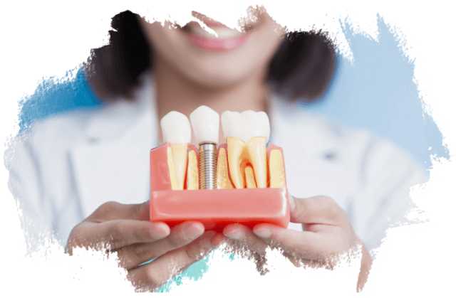 Предложение: Имплантация зубов