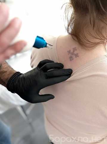 Предложение: Лазерное удаление татуажа/тату