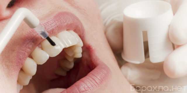 Предложение: фторирование зубов