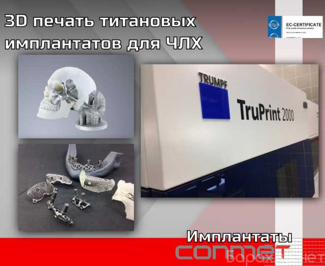 Продам: 3D печать титановых имплантатов для ЧЛХ