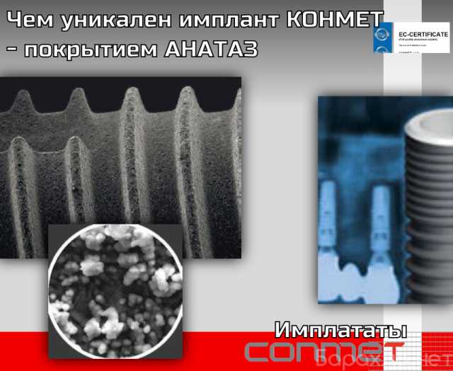 Продам: Чем уникален имплант КОНМЕТ - покрытием