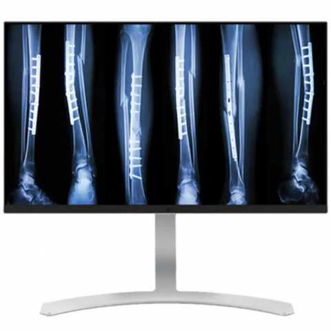 Продам: Double Black Imaging 27″ 8MP Color Clinical LED