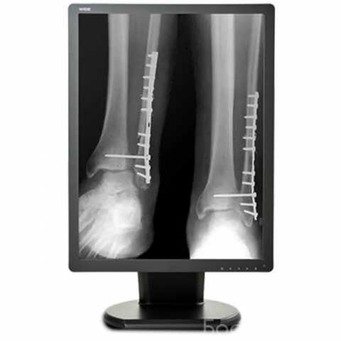 Продам: Double Black Imaging 2MP Monochrome