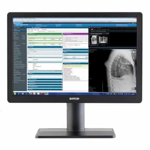 Продам: Barco Eonis 24" (MDRC-2324)