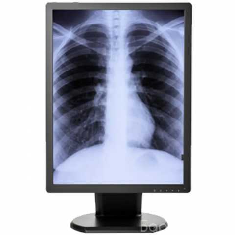 Продам: Double Black Imaging 5MP Monochrome Display For Mammography And Tomo