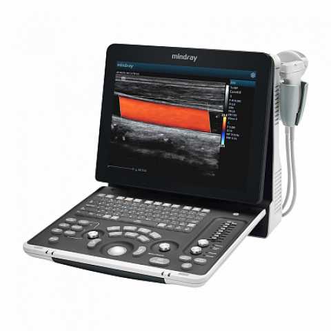 Продам: Mindray Z60 Exp