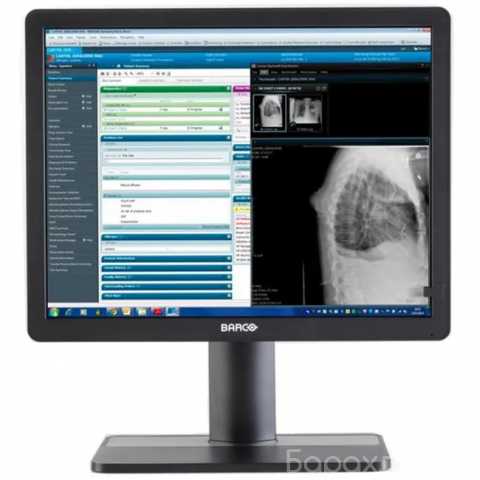 Продам: Barco Eonis 21" (MDRC-2321)