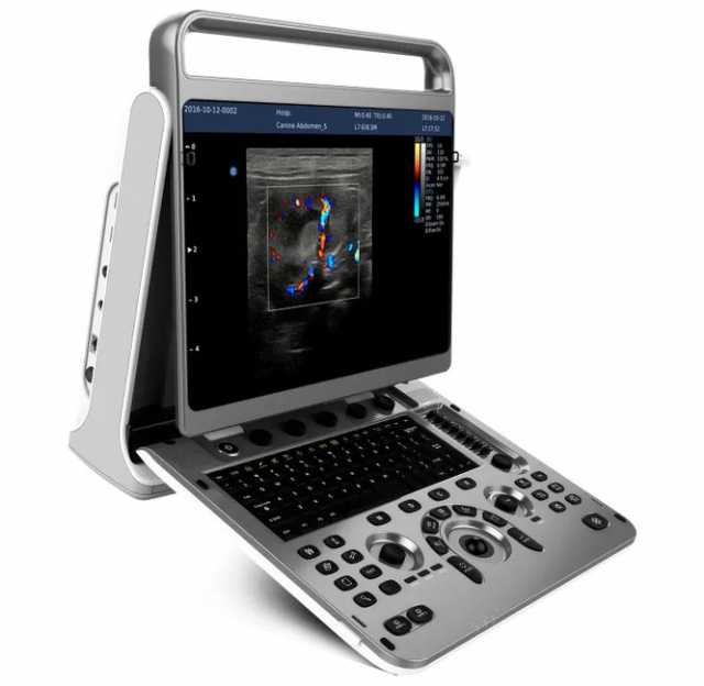 Продам: Chison SonoTouch 60 OB