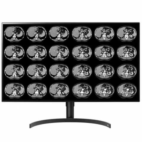 Продам: Double Black Imaging 32″ Color 8MP Large Format Display
