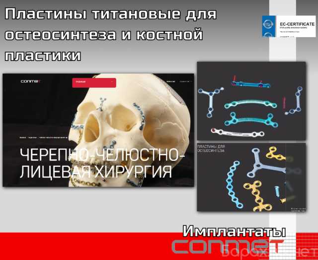 Продам: Пластины титановые для остеосинтеза и ко