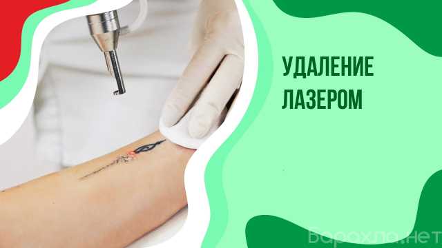 Предложение: Лазерное удаление Тату и Татуажа